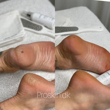 Indlæs billede til gallerivisning Instant Foot Peeling Kit